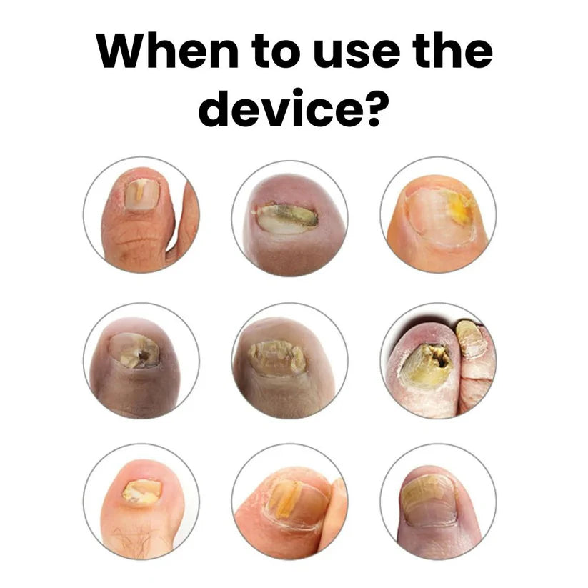 OrthoVital Device™