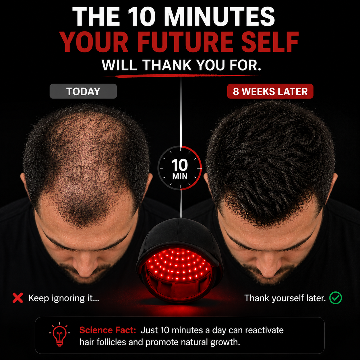 Red Light Therapy cap + Hair Regrowth Kit™