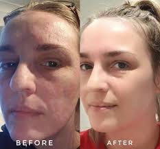 Centella Skincare Premium 5 Pcs Set